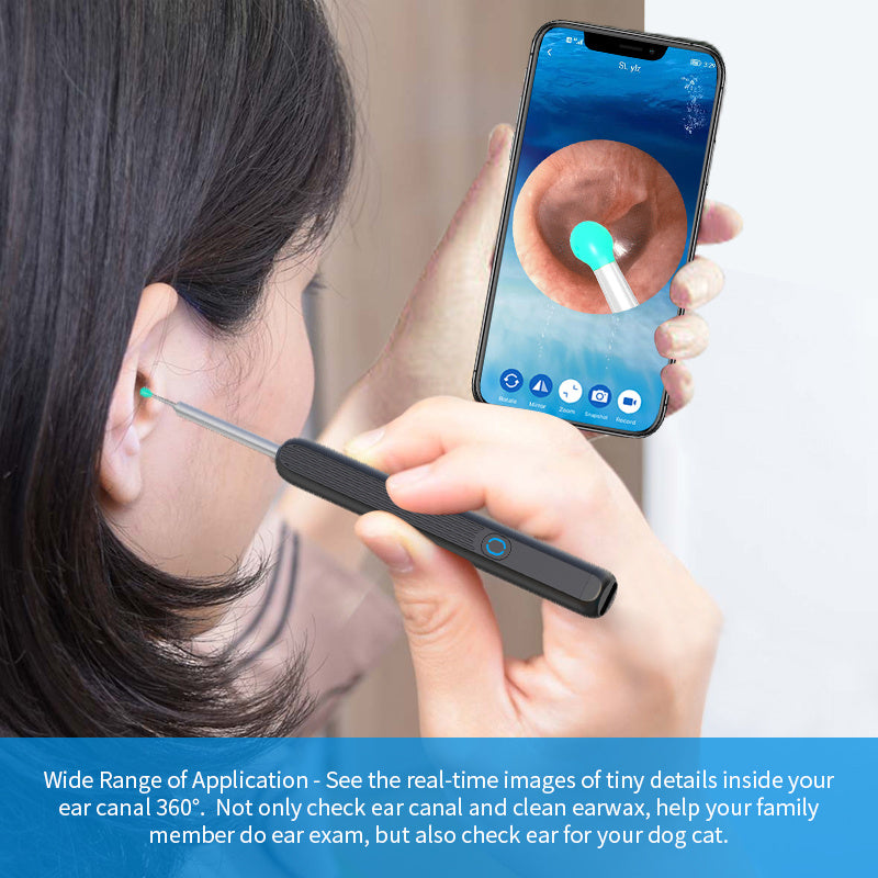 NE3 Wireless Ear Cleaner Otoscope – Ear Wax Removal Tool with Camera, LED Light & Endoscope Cleaning Kit for iPhone