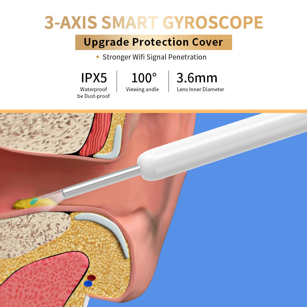 NE3 Wireless Ear Cleaner Otoscope – Ear Wax Removal Tool with Camera, LED Light & Endoscope Cleaning Kit for iPhone