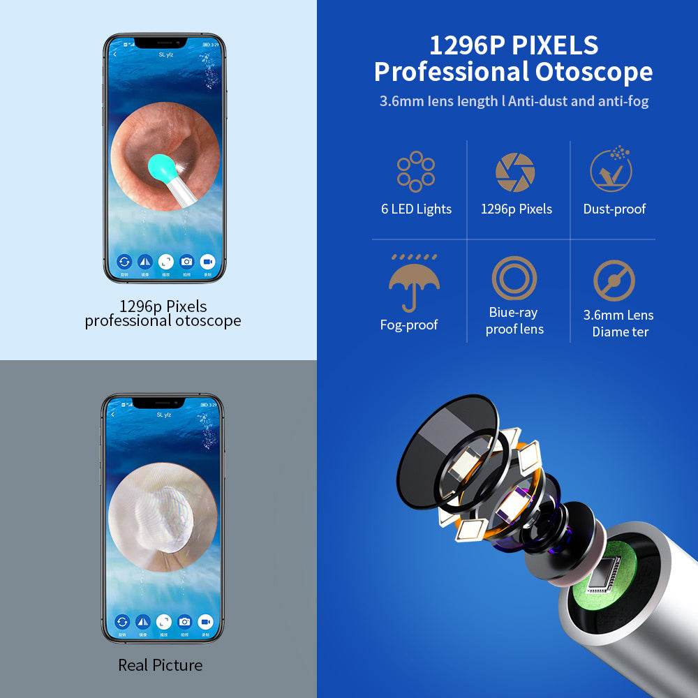 NE3 Wireless Ear Cleaner Otoscope – Ear Wax Removal Tool with Camera, LED Light & Endoscope Cleaning Kit for iPhone